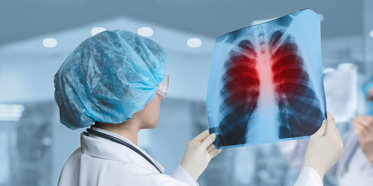 В прошлом году в Молдове туберкулезом заразились почти 2 000 человек