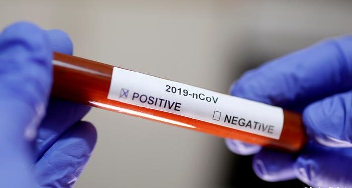 22 moldoveni au murit de Covid, în ultima săptămână: Alți 2836, testați pozitiv