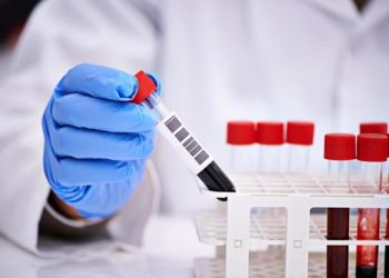 В Танзании пять человек умерли от неизвестной инфекции