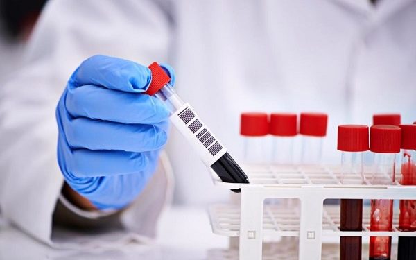 В Танзании пять человек умерли от неизвестной инфекции