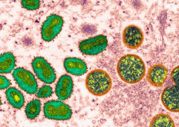 OMS anunță că variola maimuței nu mai este o urgenţă de sănătate publică