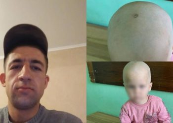 Caz șocant la Dubăsari: Un bărbat și-a stins țigara de capul fetiței fostei sale iubite