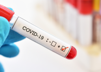 Американская разведка не нашла доказательств лабораторного происхождения COVID-19