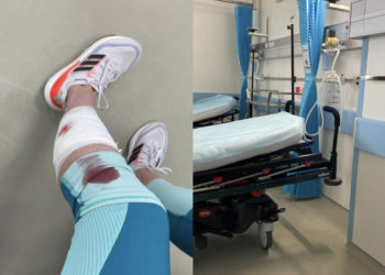 O femeie, atacată de un câine al străzii într-un parc din Chișinău: „Mi-a mușcat piciorul, aproape 2 cm în interior și a atins artera”