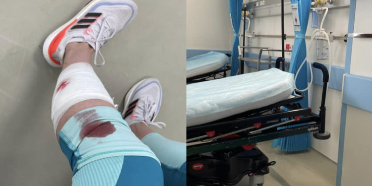 O femeie, atacată de un câine al străzii într-un parc din Chișinău: „Mi-a mușcat piciorul, aproape 2 cm în interior și a atins artera”