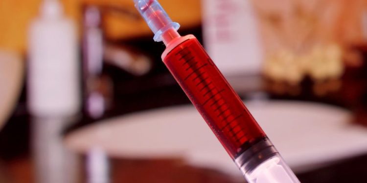 O moldoveancă, arestată în Italia: Punea otravă de șoareci în mâncarea soțului