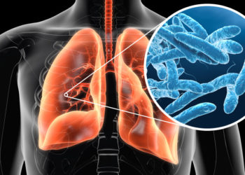 Trei oameni au murit și 71 sunt la spital, în Polonia, din cauza unei bacterii care s-ar fi dezvoltat în rețelele de alimentare cu apă