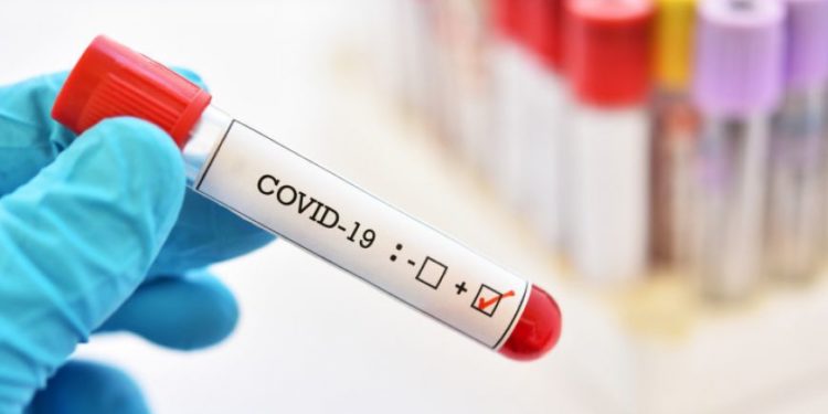 Republica Moldova s-ar putea confrunta cu un nou val de COVID-19: Săptămâna trecută, au fost înregistrate peste 440 de cazuri de infectare. Recomandările specialiștilor | VIDEO