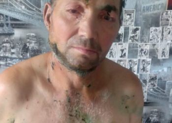 Căușeni: Un bărbat a fost desfigurat de o haită câini | VIDEO