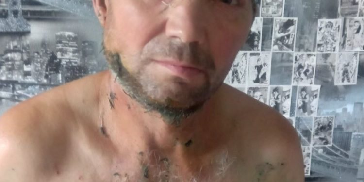 Căușeni: Un bărbat a fost desfigurat de o haită câini | VIDEO